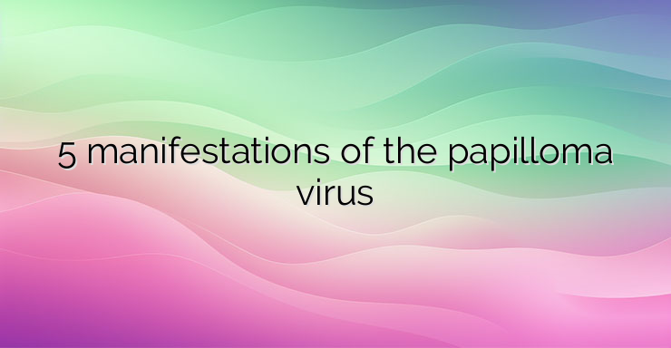 5 manifestations of the papilloma virus