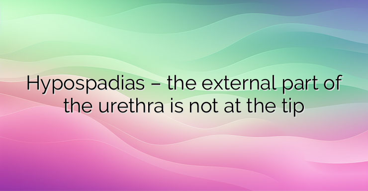 Hypospadias – the external part of the urethra is not at the tip