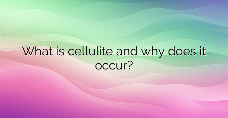 What is cellulite and why does it occur?